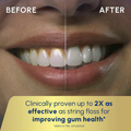 Water Flosser / Oral Irrigator - Cordless Rechargeable Dental Cleaner with 3 Modes & 4 Nozzles
