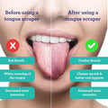 Tongue Scraper - Tongue Cleaner for Fresh Breath & Oral Hygiene