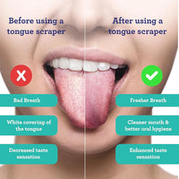 Tongue Scraper - Tongue Cleaner for Fresh Breath & Oral Hygiene