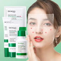 Salicylic Acid Acne Treatment Set (4-Step) - Oil Control, Pimple & Breakout Solution