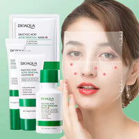 Salicylic Acid Acne Treatment Set (4-Step) - Oil Control, Pimple & Breakout Solution