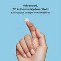 Acne Pimple Patch - Hydrocolloid Spot Treatment (48 Patches)
