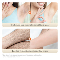 Hair Removal Cream - Fast & Gentle Depilatory for Legs, Arms, Underarms & Bikini Line