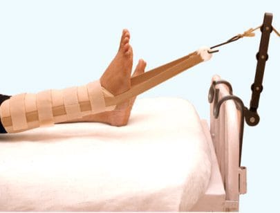 TYNOR SKIN TRACTION KIT