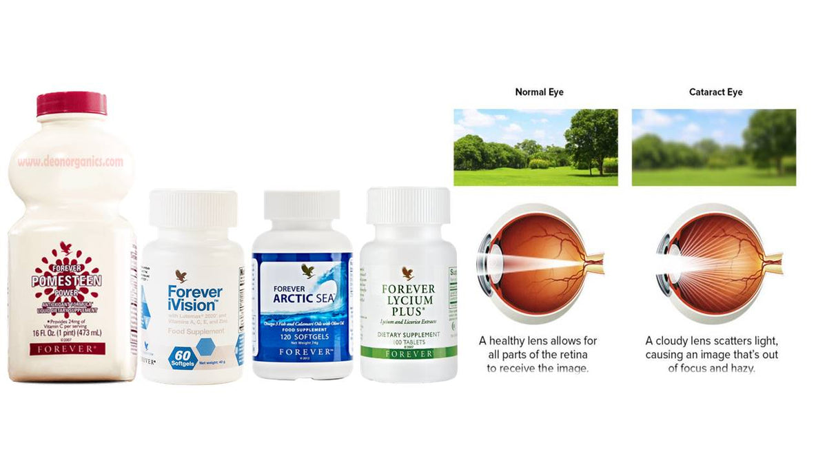 Forever Ivision Treatment for Cataracts & Gluacoma