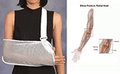MESH ARM SLING