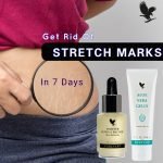 NATURAL SOLUTION FOR STECTH MARKS IN GHANA